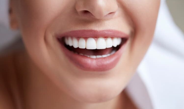 Quais os Benefícios da Lente de Contato Dental?